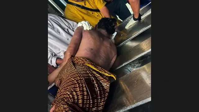 Lerai Perkelahian Pacar, Malah Pemuda di Jakbar Tewas Dilempar dari Lantai Dua, Diduga Batang Otak Rusak Lerai Perkelahian Pacar, Malah Pemuda di Jakbar ini Tewas Dilempar dari Lantai Dua, Diduga Batang Otak Rusak